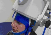 US Navy compra ‘brain zapper’ un apparecchiatura israeliana per curare i veterani – PTSD – depressione – Alzheimer- ecc..
