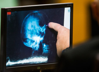 Hackerare la Mente: Gli scienziati usano magneti per cambiare gli atteggiamenti in materia di immigrazione, la religione