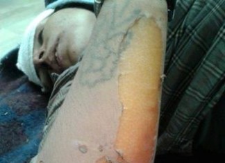 OPCW trova armi chimiche utilizzate dai ribelli contro ISIS durante gli scontri in Siria – Reuters