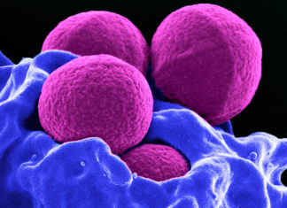 Drug-resistant bacteria brewing to become a ‘superbug’ for children