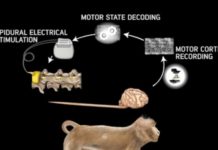 Wireless Brain Interface Can Make the Paralyzed Walk Again
