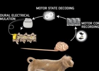 Wireless Brain Interface Can Make the Paralyzed Walk Again
