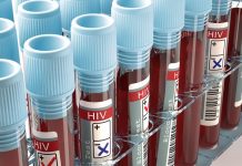 MADRID : Scientist Creates Quick New HIV Test – can detect the virus after a week