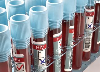 MADRID : Scientist Creates Quick New HIV Test – can detect the virus after a week