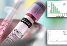 Computer program developed to diagnose and locate cancer from a blood sample