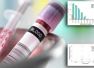 Computer program developed to diagnose and locate cancer from a blood sample