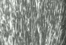 New stem cell method produces millions of human brain and muscle cells in days