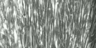 New stem cell method produces millions of human brain and muscle cells in days