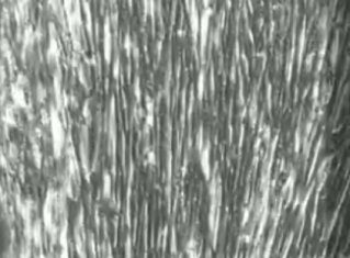 New stem cell method produces millions of human brain and muscle cells in days
