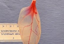 Scientists turn spinach leaf into working heart tissue