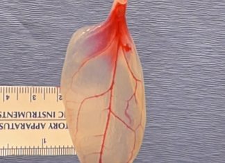Scientists turn spinach leaf into working heart tissue