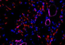 Turning skin cells into blood vessel cells while keeping them young