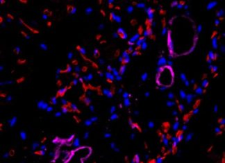 Turning skin cells into blood vessel cells while keeping them young