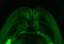Turning down the brain to erase fearful memories