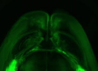 Turning down the brain to erase fearful memories