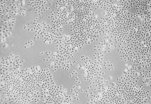 New approach makes cells resistant to HIV