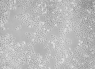 New approach makes cells resistant to HIV