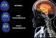 Homing System Delivers Drugs to Specific Neurons