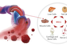 Human Umbilical Cord Blood Protein Rejuvenates Impaired Memory and Learning