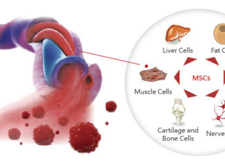 Human Umbilical Cord Blood Protein Rejuvenates Impaired Memory and Learning