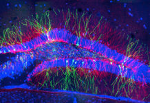 Cell Number Determines Structure of Neural Maps