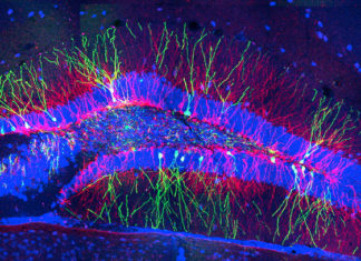 Cell Number Determines Structure of Neural Maps