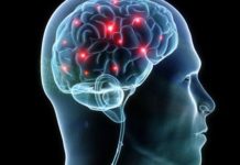 Connecting the Dots Between Dreams and Brain Disease