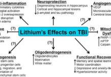Lithium May Prevent Neuron Damage In TBI Patients