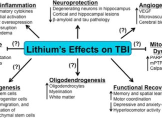 Lithium May Prevent Neuron Damage In TBI Patients