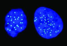 Israeli startup finds way to predict tumor resistance to chemo