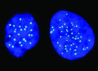 Israeli startup finds way to predict tumor resistance to chemo