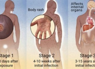 SYPHILIS STRIKE BACK – The problem of medicines