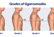 Breast reduction surgery quadruples among british man
