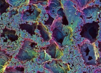 T cell traps