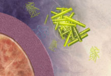 Amyloid : More in the Brain, More Cognitive Decline