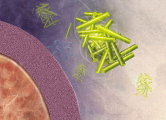 Amyloid : More in the Brain, More Cognitive Decline