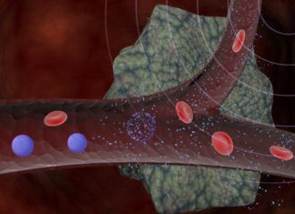 Cancer : New external activation method that can localize drug delivery anywhere you want it