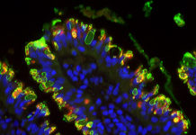 Toxoplasmosis Parasite : How to Stop it ? Target Its Stomach