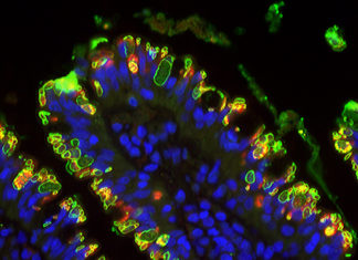Toxoplasmosis Parasite : How to Stop it ? Target Its Stomach