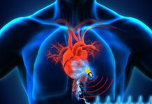 Pacemakers : Found Over 8600 Vulnerabilities