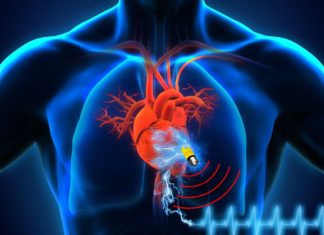 Pacemakers : Found Over 8600 Vulnerabilities