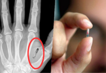 A US Firm Will Install Microchips in Employees