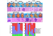 Chronic liver inflammation linked to Western diet