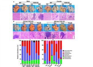 Chronic liver inflammation linked to Western diet