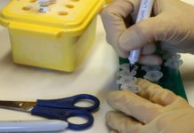 Israeli startup takes aim at Huntington’s disease