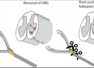 New surgical strategy offers hope for repairing spinal injuries