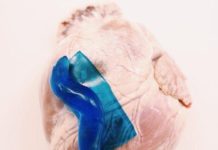 Sticky when wet: strong adhesive for wound healing