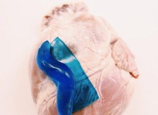 Sticky when wet: strong adhesive for wound healing