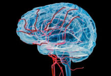 Stiff Vessels and Low Blood Flow in the Brain Forewarn of Dementia