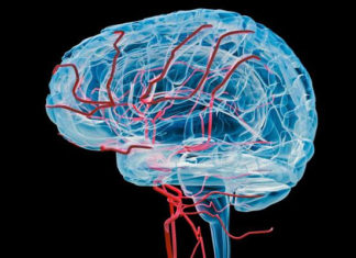 Stiff Vessels and Low Blood Flow in the Brain Forewarn of Dementia